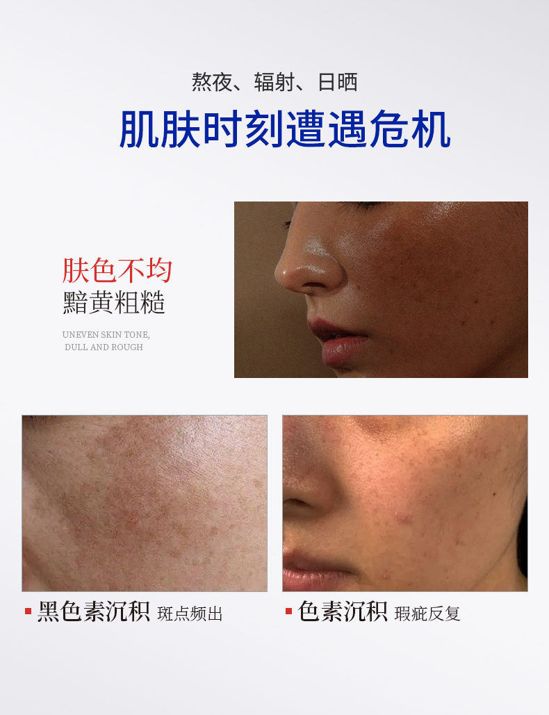 兰小集祛斑霜宣传图，展示肤色不均、暗黄粗糙的肌肤问题，突出黑色素沉积的护肤痛点