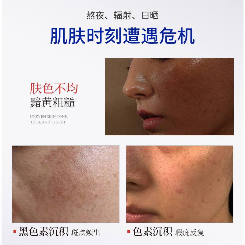 兰小集柔皙美白祛斑霜产品图2